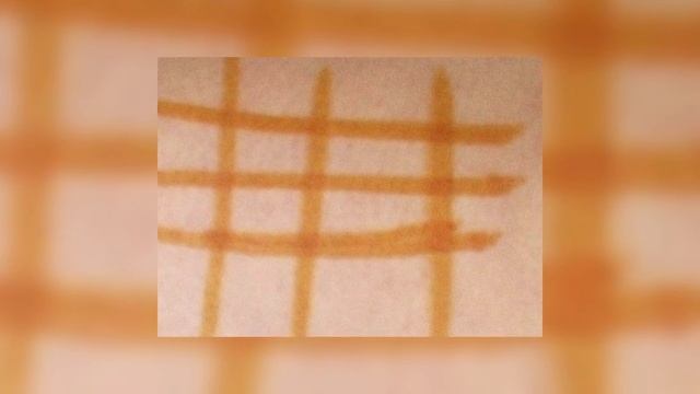 ЗАЧЕМ НА НОЧЬ МАЖУТ ПЯТКИ ЙОДОМ смотреть онлайн