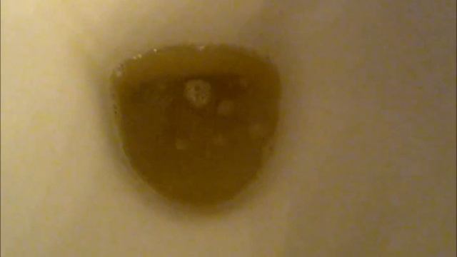 Pulire il water? incrostato, ingiallito dal calcare: come sbiancare il sanitario (?cesso) di casa! смотреть онлайн