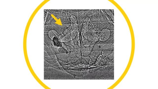 How bombardier beetles bomb смотреть онлайн