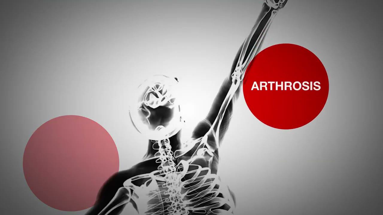 Аппараты лазерной терапии Hilterapia® AsaLaser смотреть онлайн