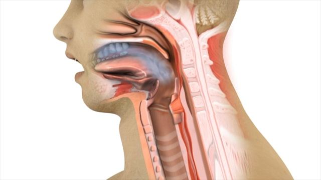 Why do Things Go Down the Wrong Way When Swallowing Sometimes (Aspiration)? смотреть онлайн