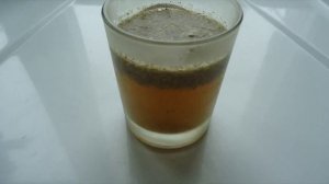 Как избавиться от камней в почках.