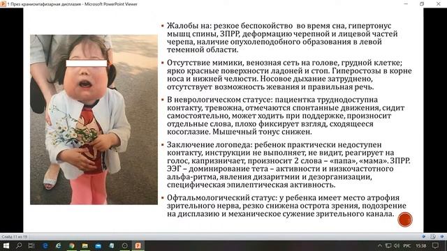 Вебинар. Тема: «Краниометафизарная дисплазия». смотреть онлайн