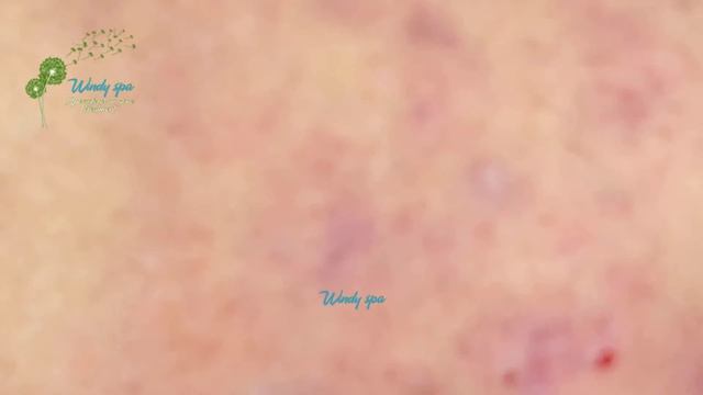 Make Your Day Relaxing with Windy Spa 6#58 смотреть онлайн