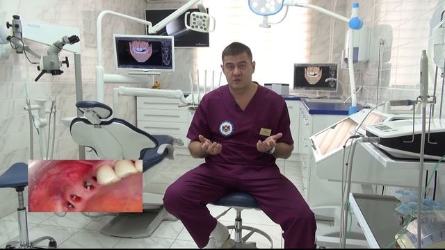 Виды стоматологических имплантатов. Плюсы и минусы каждого вида смотреть онлайн