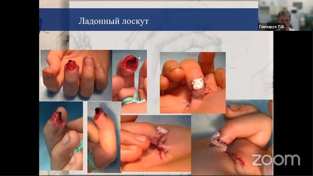 ОБЩЕСТВО ДЕТСКИХ ХИРУРГОВ МОСКВЫ И МОСКОВСКОЙ ОБЛАСТИ №615 смотреть онлайн