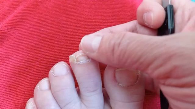 Природа мудра... наш организм способен восстанавливаться почти на 100 %. Любите себя! смотреть онлайн