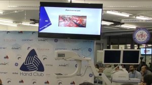 Ампутация пальцев кисти. Назарян Георгий Адольфович.