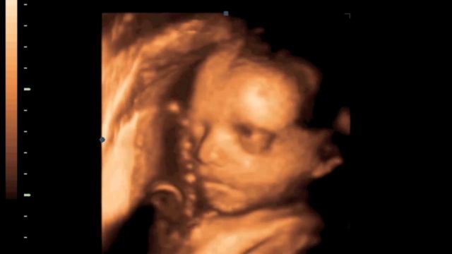 Our Baby Inside The Womb смотреть онлайн