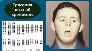 Презентация Генетика пола  Наследственные заболевания