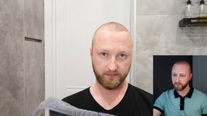 МЫТЬЕ ГОЛОВЫ | СНЯТИЕ КОРОЧЕК | ПЕРЕСАДКА ВОЛОС