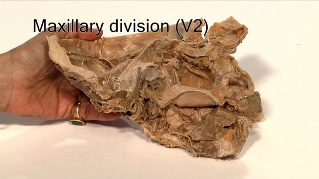 Anatomy Series, Trigmeminal Nerve by Dr. Shakti Chandra смотреть онлайн