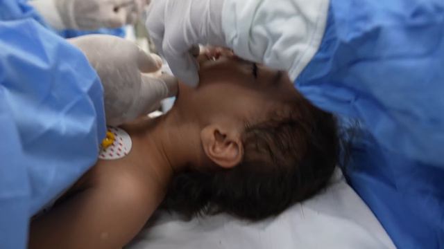 1 Year Old Child Goes Under General Anesthesia смотреть онлайн