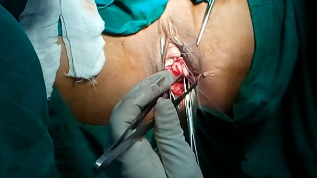 Dr Vyomesh shah NDVH смотреть онлайн