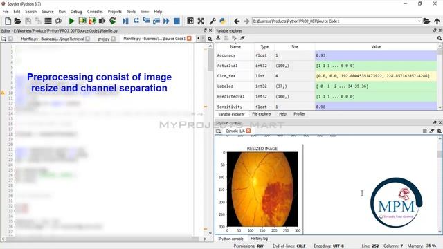 PYTHON 2021 Project - Segmentation and Classification of Diabetic Retinopathy Using Python | DIP смотреть онлайн