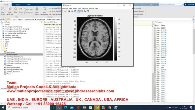 Medical image noise removal using CNN and image composition using MATLAB || MATLAB projects смотреть онлайн