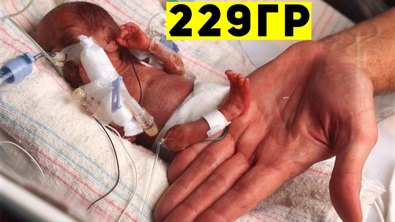 Они Одни Такие! 10 Самых Необычных Детей в Мире смотреть онлайн