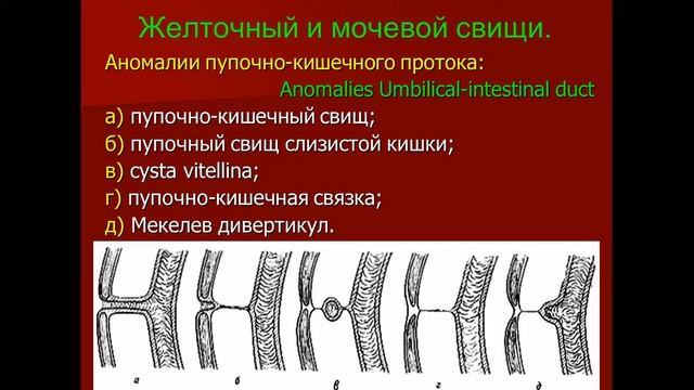 Лекция №7 Хирургическая анатомия переднебоковой стенки живота Грыжи смотреть онлайн