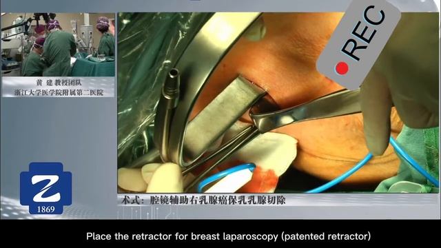 Laparoscopic Breast Conserving Surgery and Sentinel Lymph Node Biopsy by Dr. HUANG Jian смотреть онлайн
