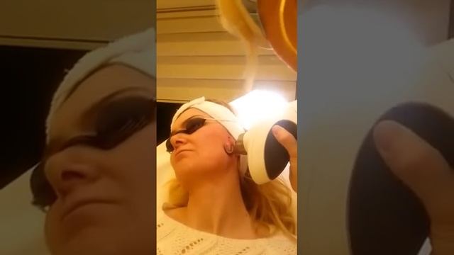 4D Lazer Tüm Yüz Lazer Lifting Ve Rejuvenasyon