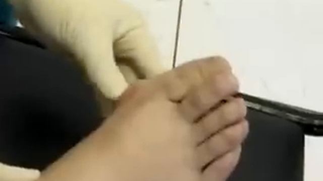 Коррекция ног.