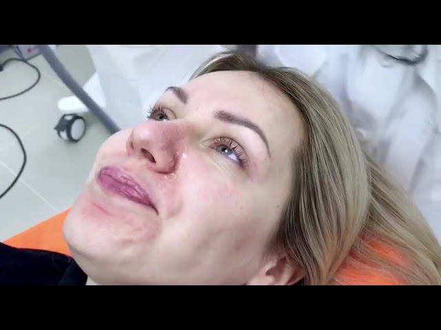 Крылья носа смотреть онлайн