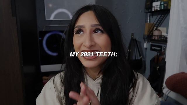 I tried the crest 3D whitestrips for 14 days *effective* 2023 смотреть онлайн