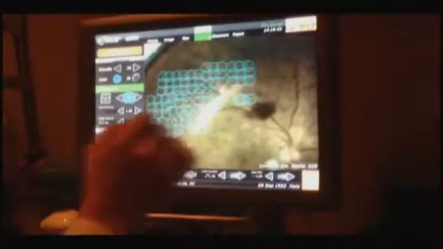 Navilas® Navigated PRP смотреть онлайн