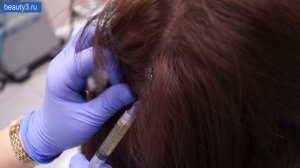 Плазмотерапия волосистой части головы