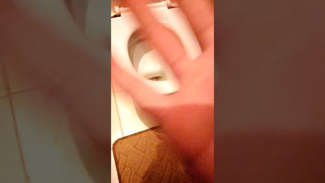 Натер мозоли на руках упал подвернул ногу смотреть онлайн