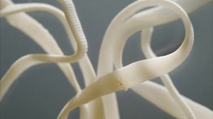 Как избавиться от глистов в домашних условиях?