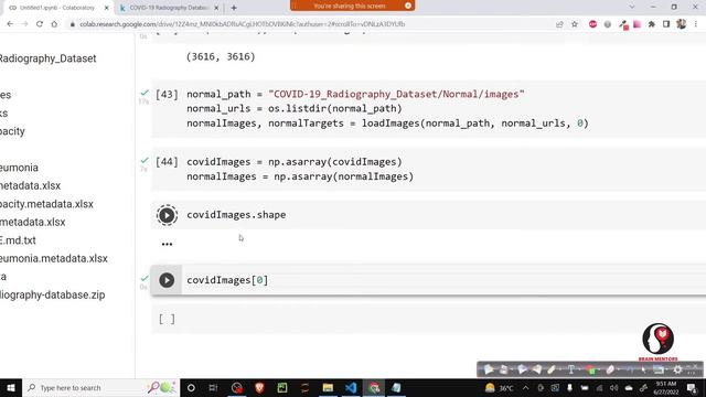 Deep Learning Chest Xray Classification Using CNN | Tensorflow | Brain Mentors смотреть онлайн