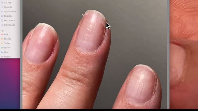 Torn Nails Problem [Anna's Nail Advice] смотреть онлайн