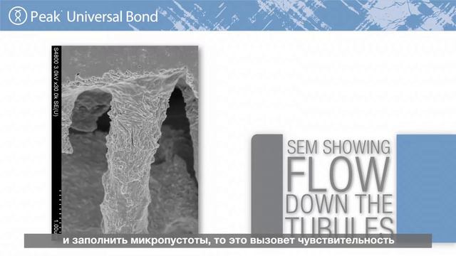 Нил Джессоп – Peak Universal Bond смотреть онлайн