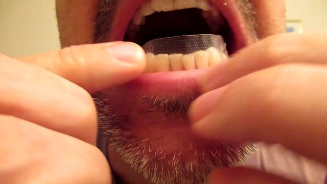 Crest Whitestrips RESULTS Test Review WOW!!! 3D Classic Vivid teeth whitening kit смотреть онлайн