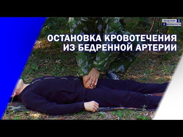Остановка кровотечения из бедренной артерии смотреть онлайн