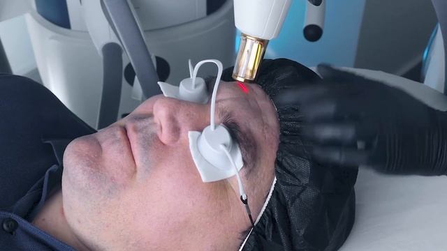 Как избавиться от МОРЩИН без БОТОКСА и других инъекций. смотреть онлайн