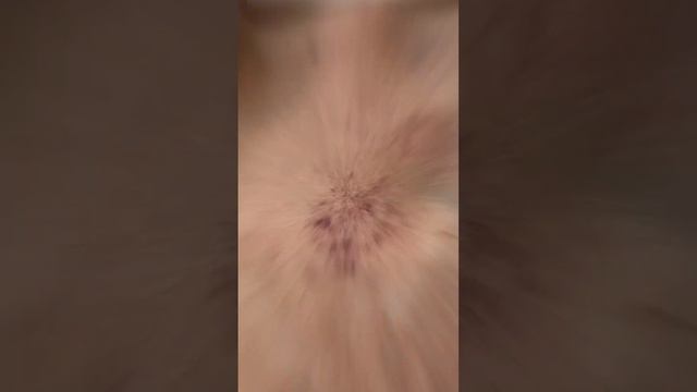 Фотоомоложение LUMECCA . Результат после первой процедуры смотреть онлайн
