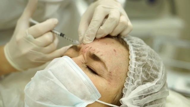 Ботулинотерапия смотреть онлайн