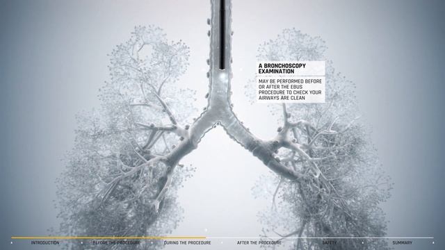 EBUS guide for patients: bronchoscopy technique for chest abnormalities смотреть онлайн