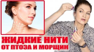 Жидкие нити от птоза, от морщин! Курсом. Показываю, какие работают, какие нет. Не реклама.