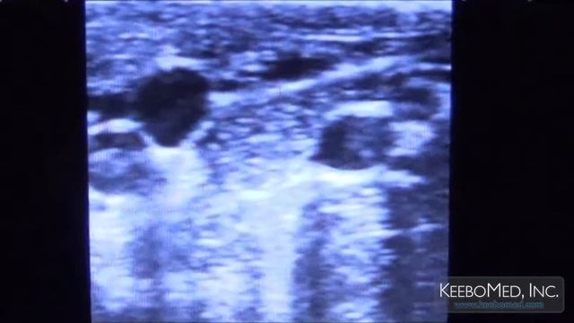 KX5000V VS Siui CTS 800 Comparison Between two veterinary Handheld ultrasounds смотреть онлайн