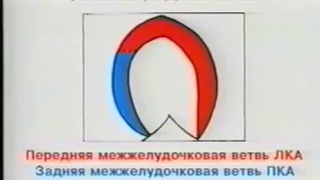 Эхокардиография, УЗИ сердца, методика исследования смотреть онлайн