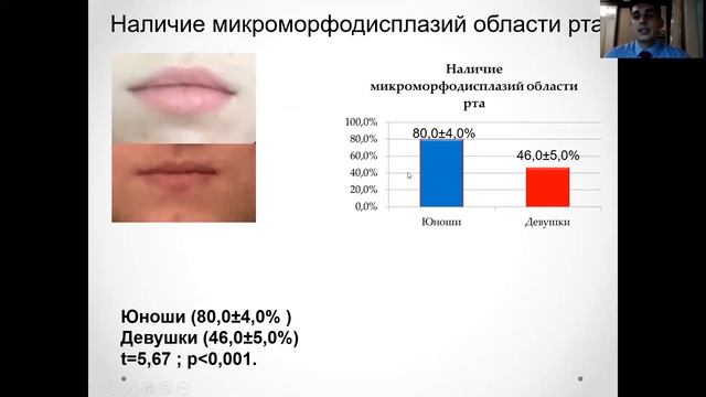 ЧАСТОТА МИКРОМОРФОДИСПЛАЗИЙ У ЮНОШЕЙ И ДЕВУШЕК смотреть онлайн