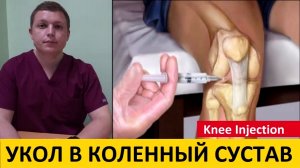 Внутрисуставные инъекции в коленный сустав Knee Injection