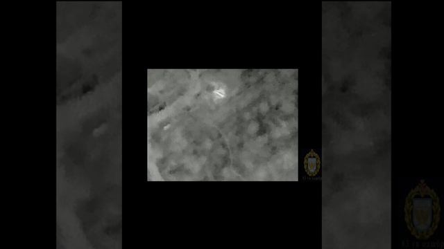 Ланцеты 83 смотреть онлайн