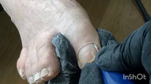 Преображение ножек зрелой дамы. Педикюр пальчики