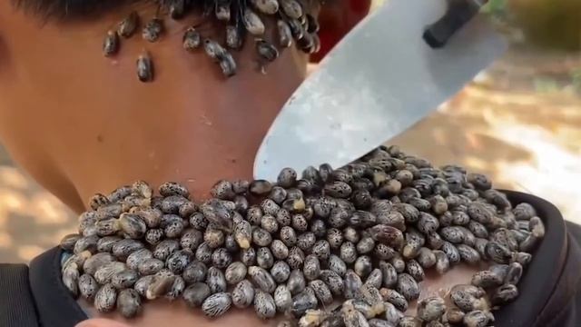 Эти КЛЕЩИ Чуть Не Съели Парня Живьем! Удаление Сотен Клещей. смотреть онлайн