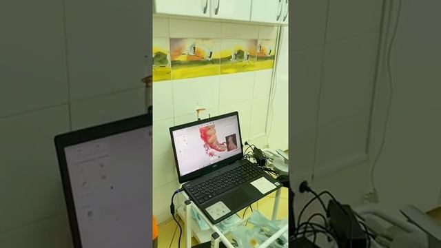 Внутриротовой сканер. Продолжение смотреть онлайн