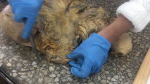 Брюшина. Топография брюшины среднего и нижнего этажа.